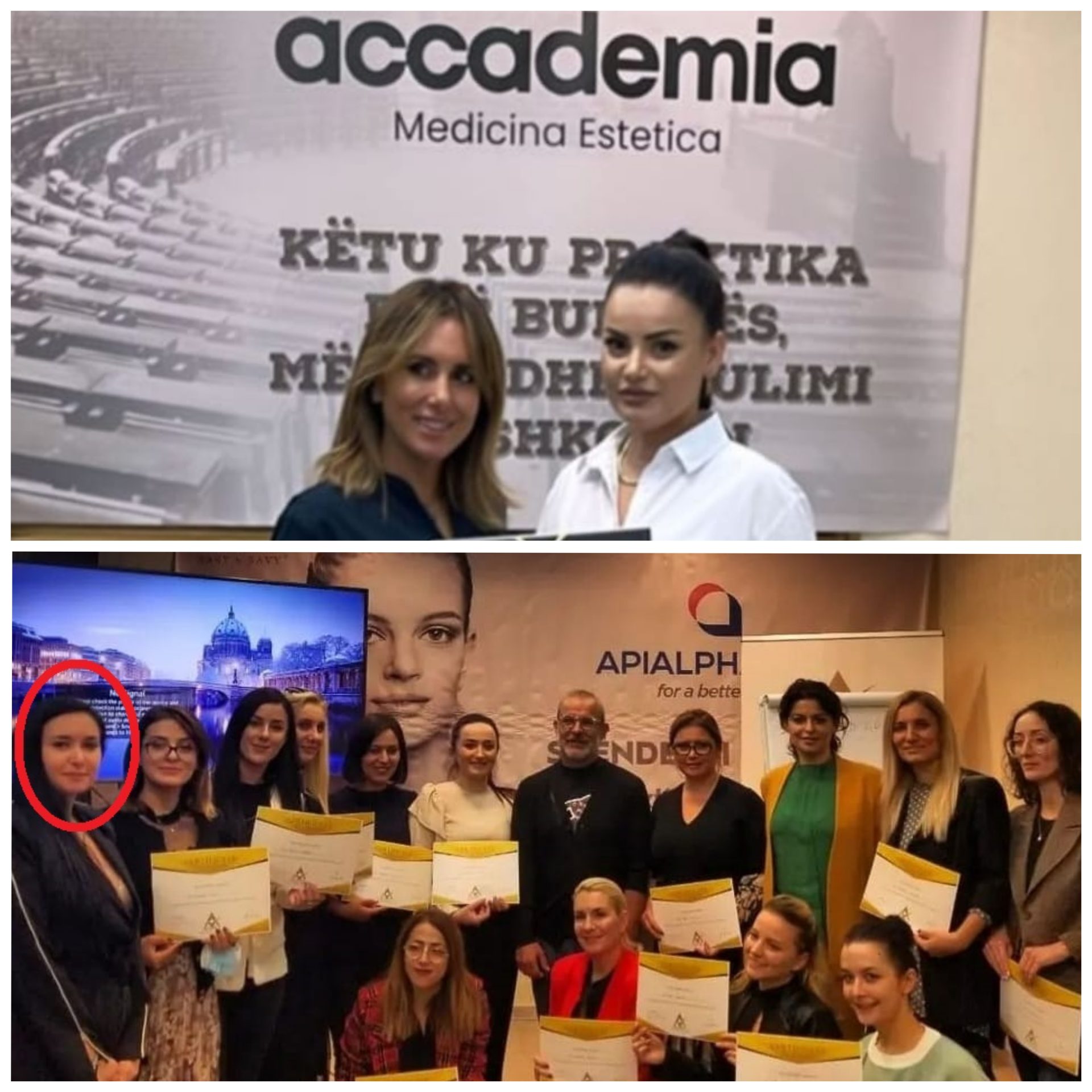 Skandal!  Si po pajisen parukieret shqiptare me licenca botoksi nga “akademi” instagrami?! Në skenë ‘diplomatja’ e Xhaçkës që hiqet si mjeke